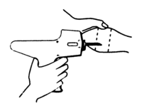 Rear view of the bovine ear showing the site for insertion of the implanter needle.